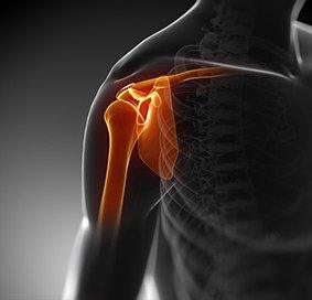 Shoulder Ligament Injuries