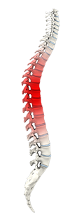 Spine Trauma